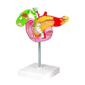 Pathological Model of the Pancreas, Duodenum and Gallbladder